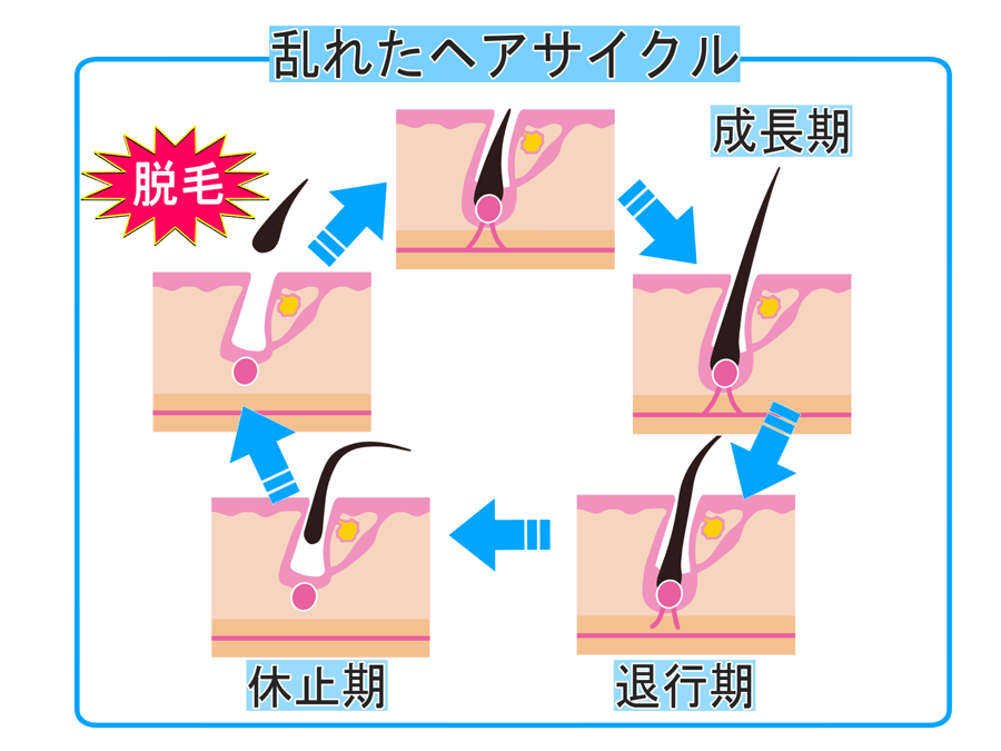 AGA・薄毛・発毛専門サロン「発毛ラボ和歌山」へ！