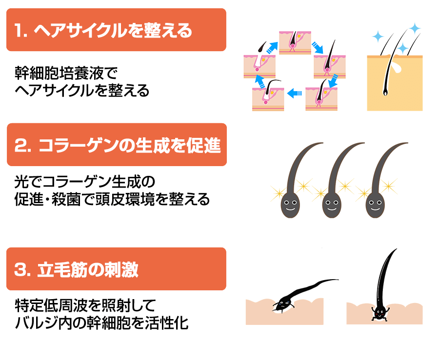 「発毛ラボ和歌山」へ！